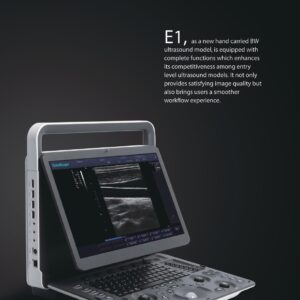 ECOGRAFO  SONOESCAPE E1