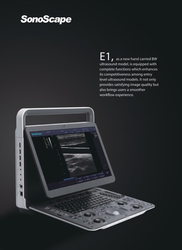 ECOGRAFO  SONOESCAPE E1