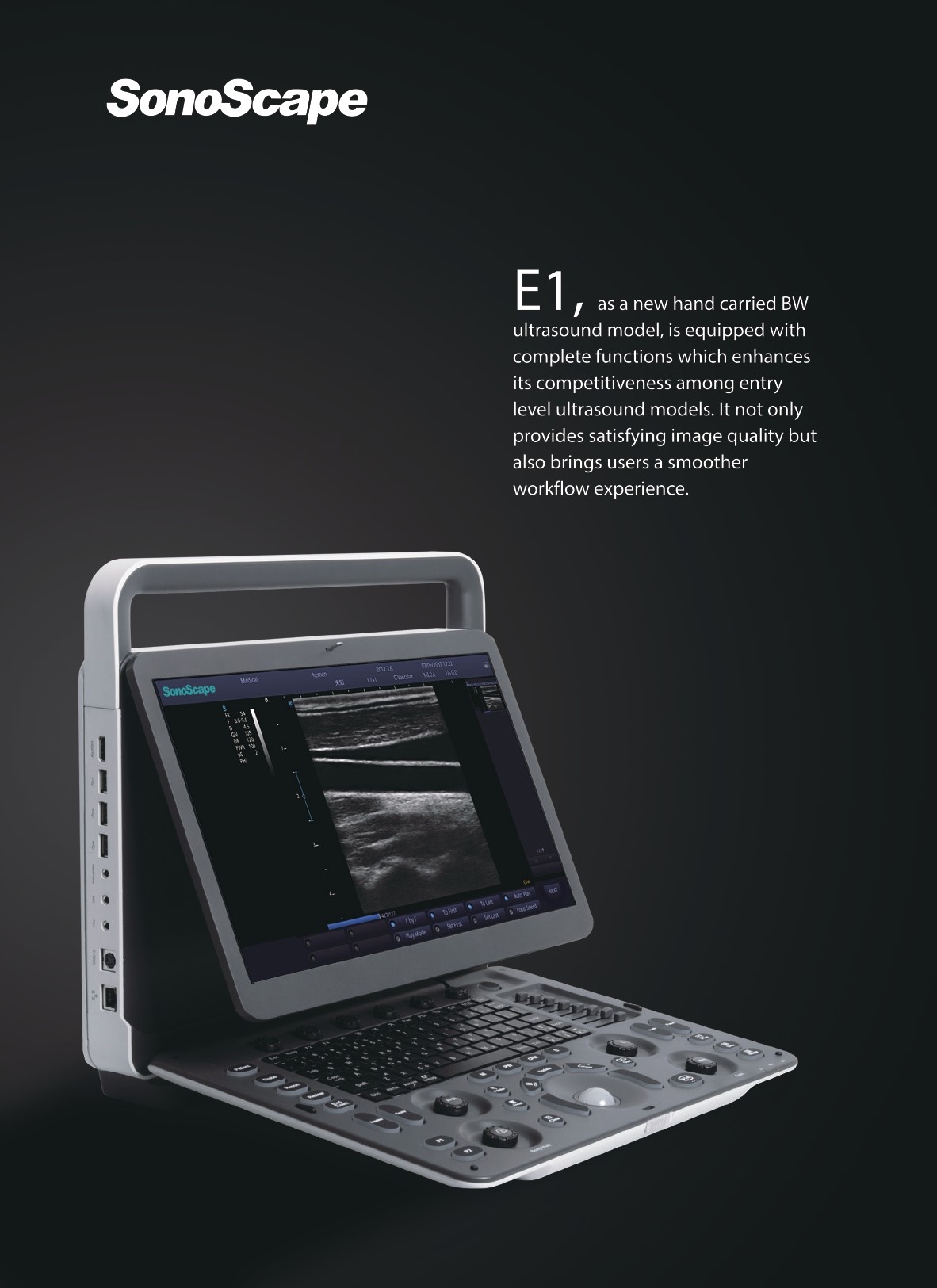 ECOGRAFO  SONOESCAPE E1