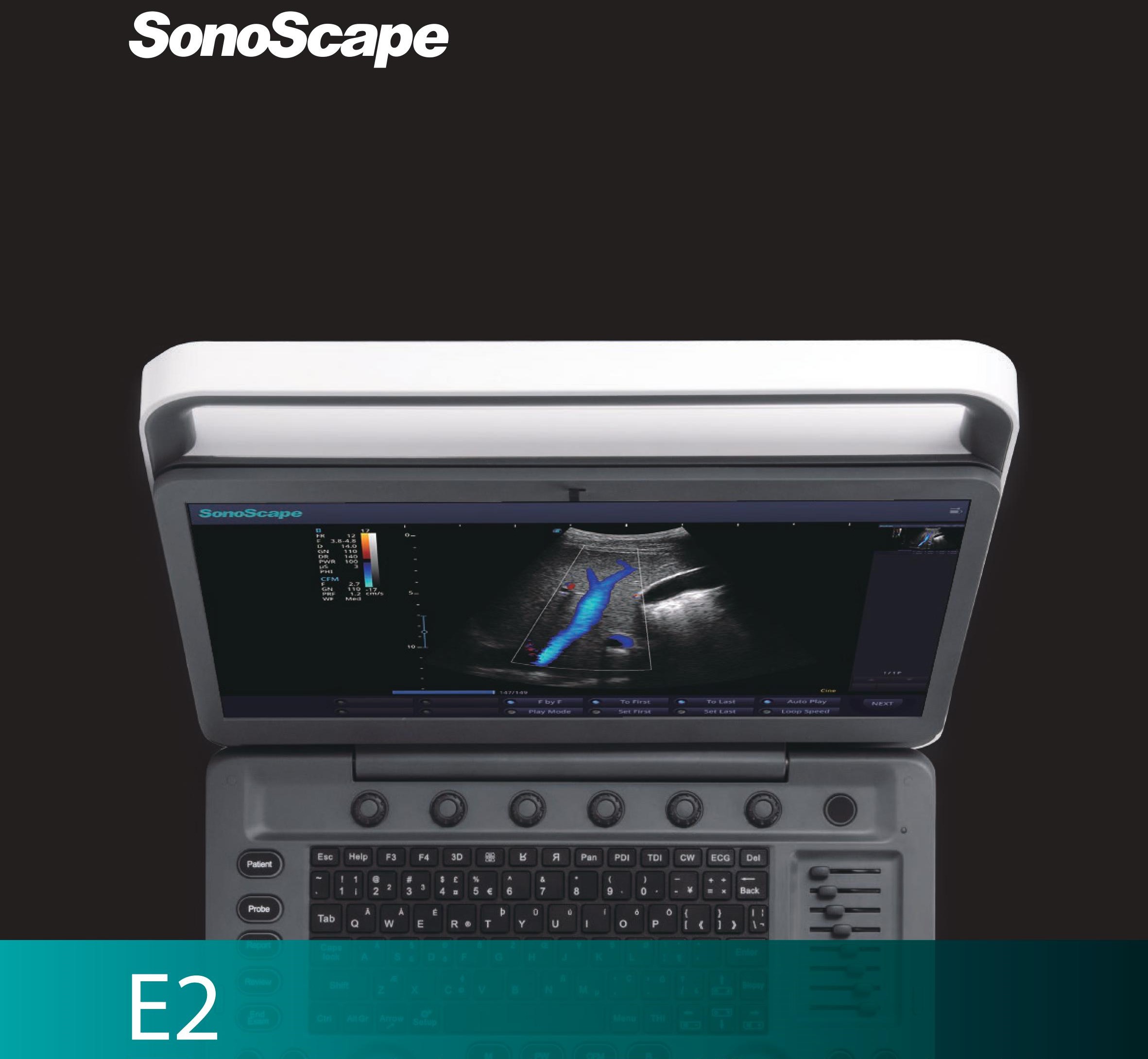Ecógrafo E2